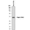 Dickkopf Like Acrosomal Protein 1 antibody, AF1508, R&D Systems, Western Blot image 