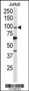 DNA polymerase delta catalytic subunit antibody, 61-563, ProSci, Western Blot image 