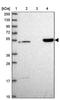 DENN Domain Containing 2D antibody, PA5-61792, Invitrogen Antibodies, Western Blot image 