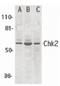 Checkpoint Kinase 2 antibody, orb87305, Biorbyt, Western Blot image 