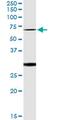 Oxidative Stress Responsive Kinase 1 antibody, MA5-20866, Invitrogen Antibodies, Immunoprecipitation image 