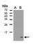C-C Motif Chemokine Ligand 5 antibody, GTX108441, GeneTex, Western Blot image 