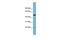 HAUS Augmin Like Complex Subunit 7 antibody, GTX44996, GeneTex, Western Blot image 