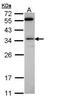 Syndecan Binding Protein antibody, PA5-28813, Invitrogen Antibodies, Western Blot image 