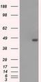 Branched Chain Keto Acid Dehydrogenase Kinase antibody, MA5-24992, Invitrogen Antibodies, Western Blot image 