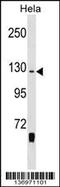 Nuclear Receptor Binding SET Domain Protein 2 antibody, 58-927, ProSci, Western Blot image 