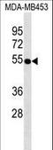 Vitamin D Receptor antibody, LS-C157348, Lifespan Biosciences, Western Blot image 