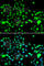 Inositol Hexakisphosphate Kinase 2 antibody, A7192, ABclonal Technology, Immunofluorescence image 