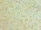 BAF Chromatin Remodeling Complex Subunit BCL11A antibody, LS-C379578, Lifespan Biosciences, Immunohistochemistry paraffin image 