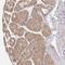 Zw10 Kinetochore Protein antibody, NBP2-38644, Novus Biologicals, Immunohistochemistry paraffin image 