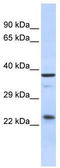 SERTA Domain Containing 1 antibody, TA335640, Origene, Western Blot image 