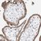 Taspase 1 antibody, HPA030825, Atlas Antibodies, Immunohistochemistry paraffin image 