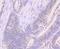 Forkhead Box P1 antibody, NBP2-66853, Novus Biologicals, Immunohistochemistry paraffin image 