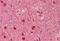 Doublecortin antibody, MBS249073, MyBioSource, Immunohistochemistry paraffin image 