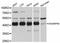 SHANK Associated RH Domain Interactor antibody, LS-C747391, Lifespan Biosciences, Western Blot image 