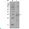 Coagulation Factor VIII antibody, LS-C812466, Lifespan Biosciences, Western Blot image 
