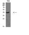 Casein Kinase 1 Alpha 1 antibody, STJ98622, St John