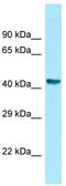 Zinc finger HIT domain-containing protein 2 antibody, TA342838, Origene, Western Blot image 