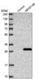 Abhydrolase Domain Containing 14B antibody, PA5-57748, Invitrogen Antibodies, Western Blot image 