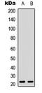 Inducible T Cell Costimulator antibody, LS-C368597, Lifespan Biosciences, Western Blot image 