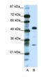 Glial Cells Missing Transcription Factor 1 antibody, orb329550, Biorbyt, Western Blot image 