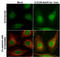 Cofilin 1 antibody, GTX102156, GeneTex, Immunocytochemistry image 