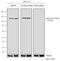 Janus Kinase 2 antibody, 710928, Invitrogen Antibodies, Western Blot image 