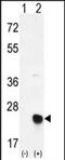 Methionine Sulfoxide Reductase B2 antibody, PA5-72509, Invitrogen Antibodies, Western Blot image 