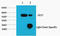 Keratin 17 antibody, STJ96983, St John