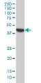 Apoptosis facilitator Bcl-2-like protein 14 antibody, H00079370-M01, Novus Biologicals, Western Blot image 