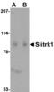 SLIT And NTRK Like Family Member 1 antibody, A07507, Boster Biological Technology, Western Blot image 