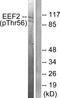 Eukaryotic Translation Elongation Factor 2 antibody, LS-C198899, Lifespan Biosciences, Western Blot image 