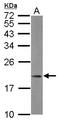 Mitochondrial Ribosomal Protein L21 antibody, LS-C155664, Lifespan Biosciences, Western Blot image 