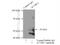 Activin A Receptor Like Type 1 antibody, 14745-1-AP, Proteintech Group, Immunoprecipitation image 