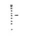 FGR Proto-Oncogene, Src Family Tyrosine Kinase antibody, PA5-79264, Invitrogen Antibodies, Western Blot image 