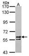 Chaperonin Containing TCP1 Subunit 6A antibody, PA5-28200, Invitrogen Antibodies, Western Blot image 