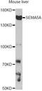 Semaphorin 5A antibody, A14817, ABclonal Technology, Western Blot image 