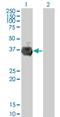 Ring Finger And FYVE Like Domain Containing E3 Ubiquitin Protein Ligase antibody, H00117584-M01, Novus Biologicals, Western Blot image 