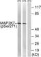 Mitogen-Activated Protein Kinase Kinase 7 antibody, TA312581, Origene, Western Blot image 