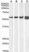 Desmin antibody, PA5-19063, Invitrogen Antibodies, Western Blot image 