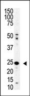 SUMO Peptidase Family Member, NEDD8 Specific antibody, AP11263PU-N, Origene, Western Blot image 