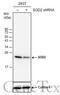 Superoxide Dismutase 2 antibody, GTX630560, GeneTex, Western Blot image 