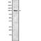 Solute Carrier Family 4 Member 1 (Diego Blood Group) antibody, abx218630, Abbexa, Western Blot image 