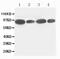 FES Proto-Oncogene, Tyrosine Kinase antibody, PA1854-1, Boster Biological Technology, Western Blot image 