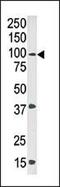 ABL Proto-Oncogene 1, Non-Receptor Tyrosine Kinase antibody, PA5-12532, Invitrogen Antibodies, Western Blot image 