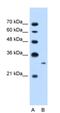 MAP3K7 C-Terminal Like antibody, 29-772, ProSci, Western Blot image 