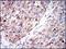 Glucose-6-Phosphate Dehydrogenase antibody, NBP2-22125, Novus Biologicals, Immunohistochemistry frozen image 