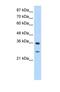 GIPC PDZ Domain Containing Family Member 2 antibody, NBP1-55244, Novus Biologicals, Western Blot image 
