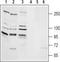 Transient Receptor Potential Cation Channel Subfamily M Member 2 antibody, TA328746, Origene, Western Blot image 