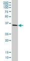 Mitogen-Activated Protein Kinase Kinase 3 antibody, H00005606-M02, Novus Biologicals, Western Blot image 